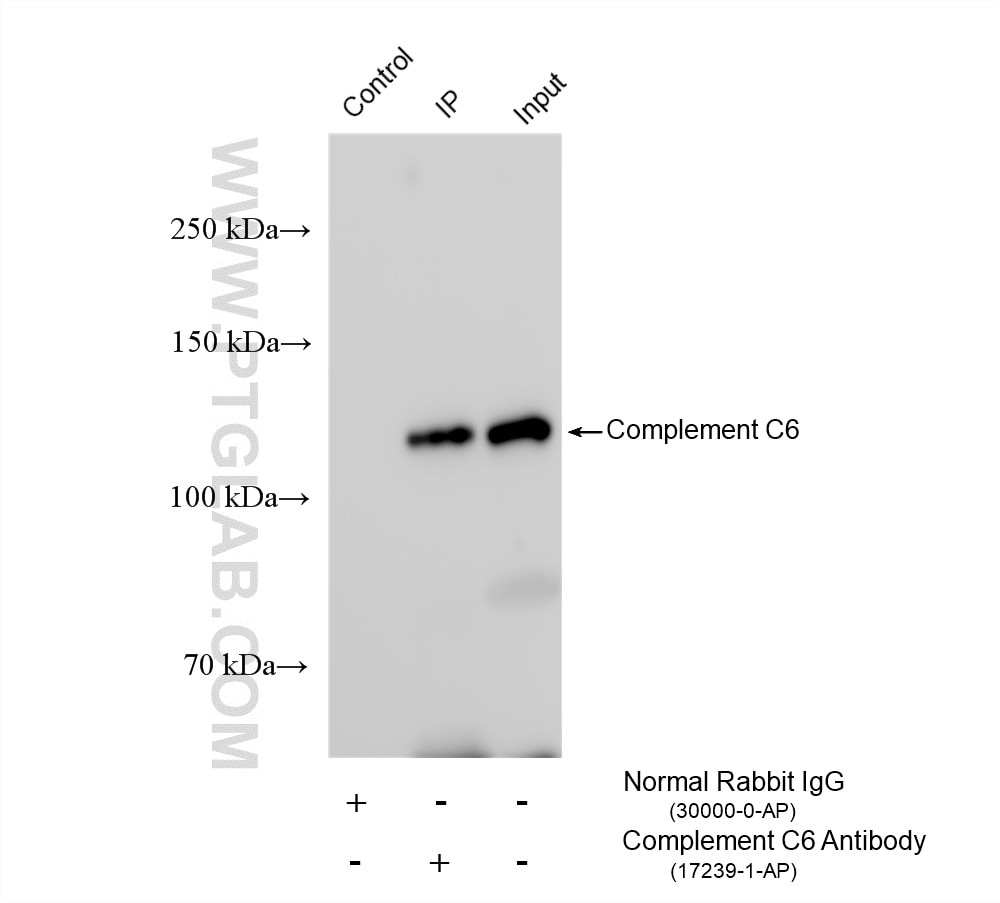 Immunoprecipitation (IP) experiment of human plasma using Complement C6 Polyclonal antibody (17239-1-AP)