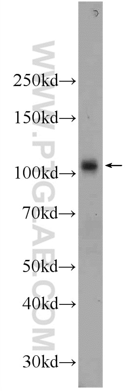 WB analysis of human blood using 17239-1-AP