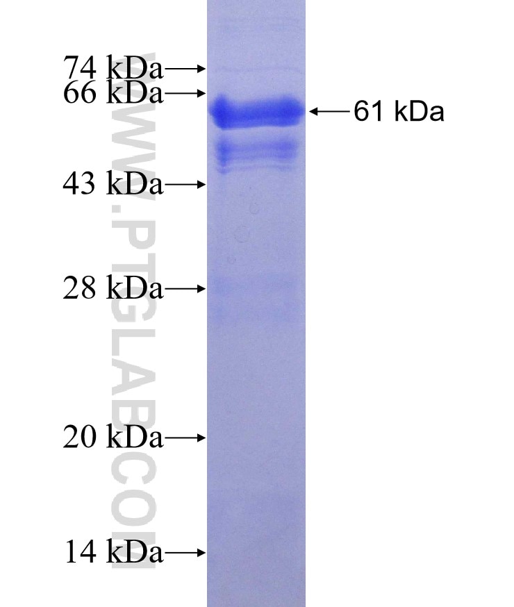 C6orf106 fusion protein Ag13882 SDS-PAGE