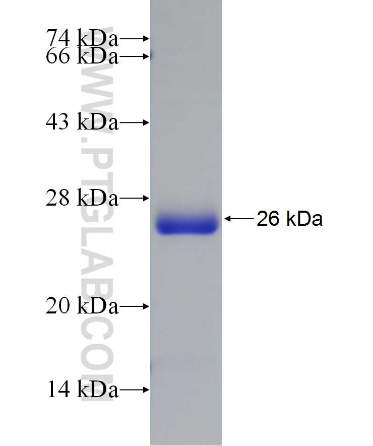 C6orf108 fusion protein Ag22382 SDS-PAGE