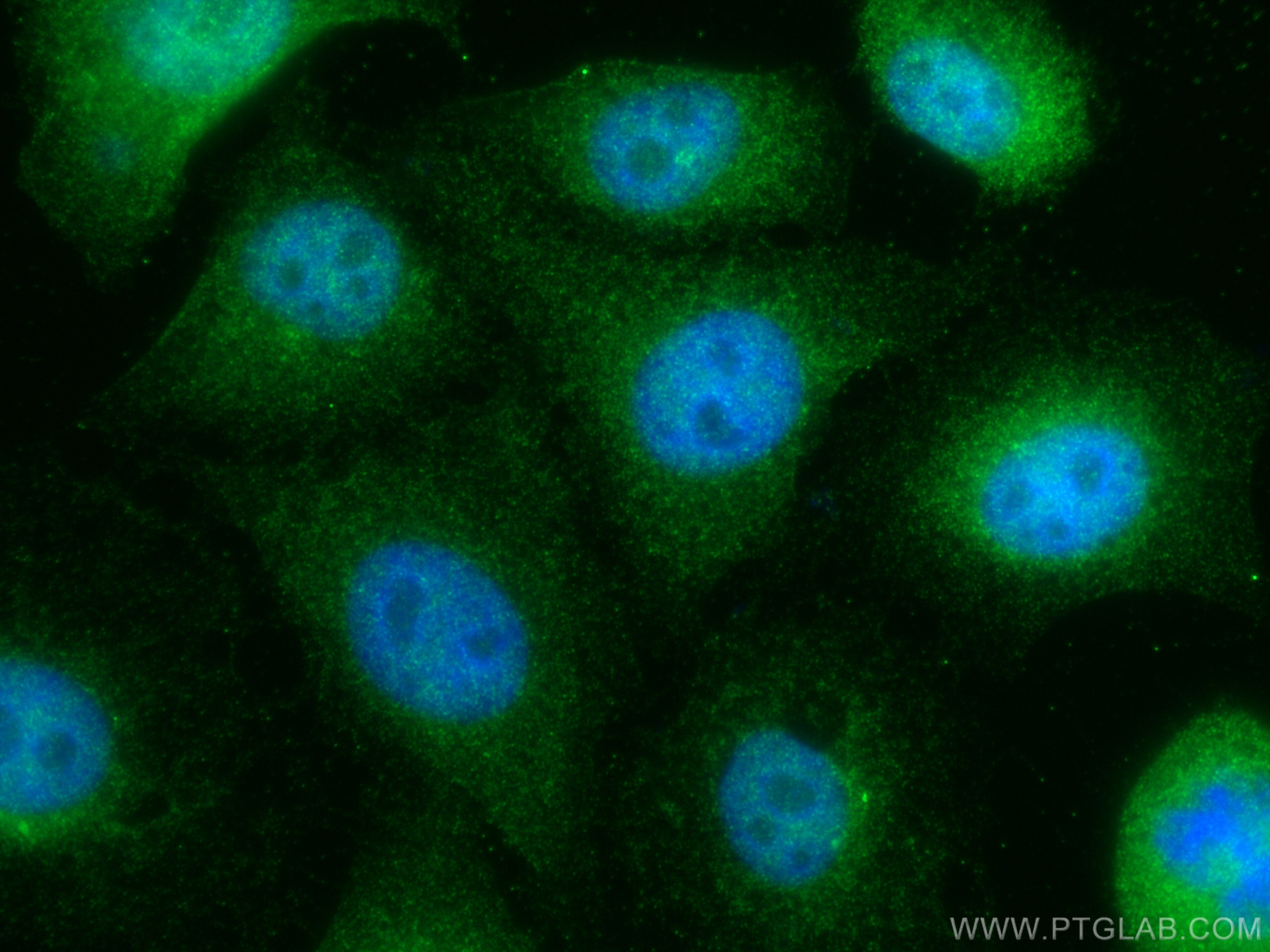 Immunofluorescence (IF) / fluorescent staining of A549 cells using ATAT1 Polyclonal antibody (28828-1-AP)