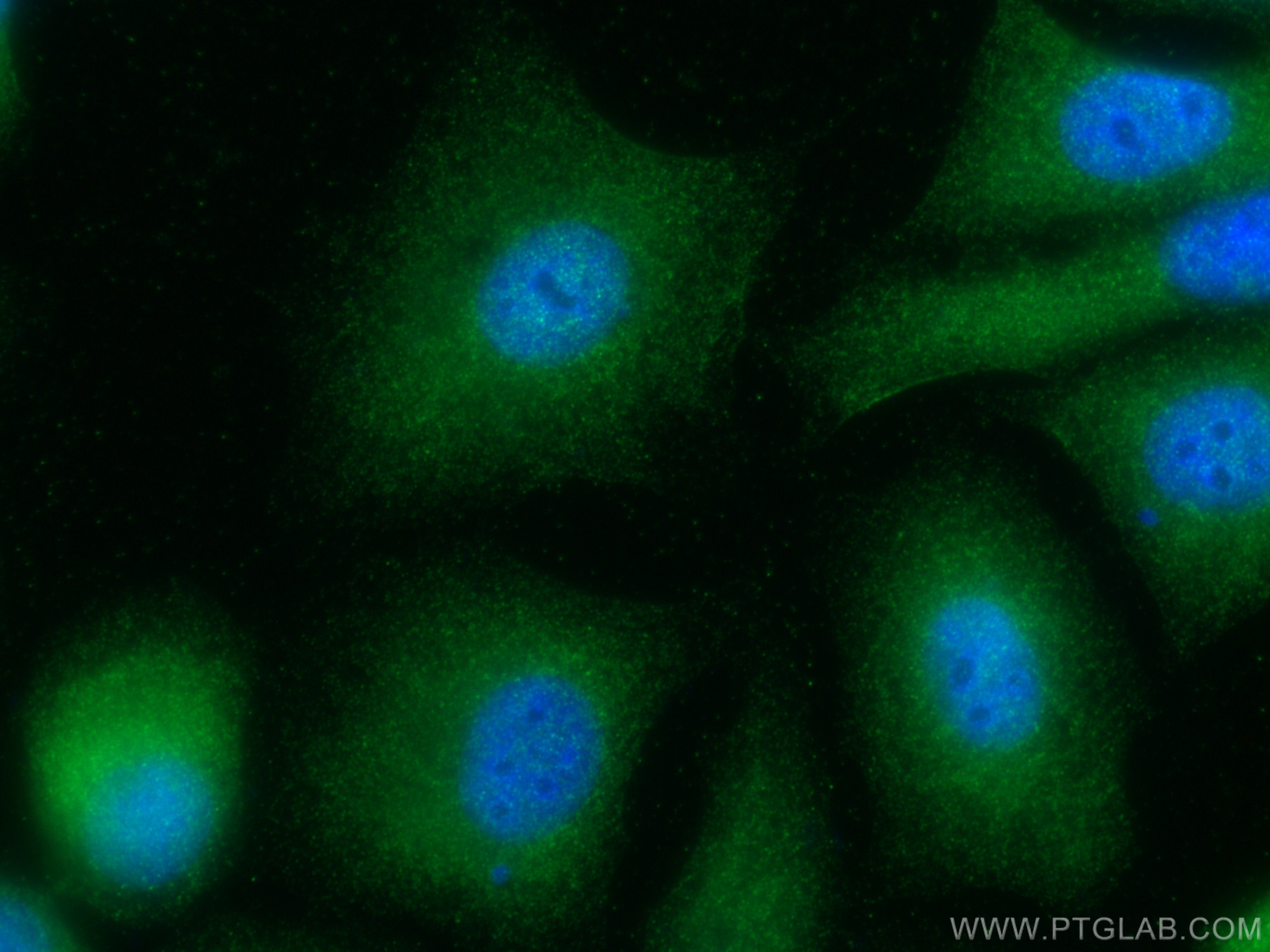 Immunofluorescence (IF) / fluorescent staining of A549 cells using C6orf134 Polyclonal antibody (28828-1-AP)