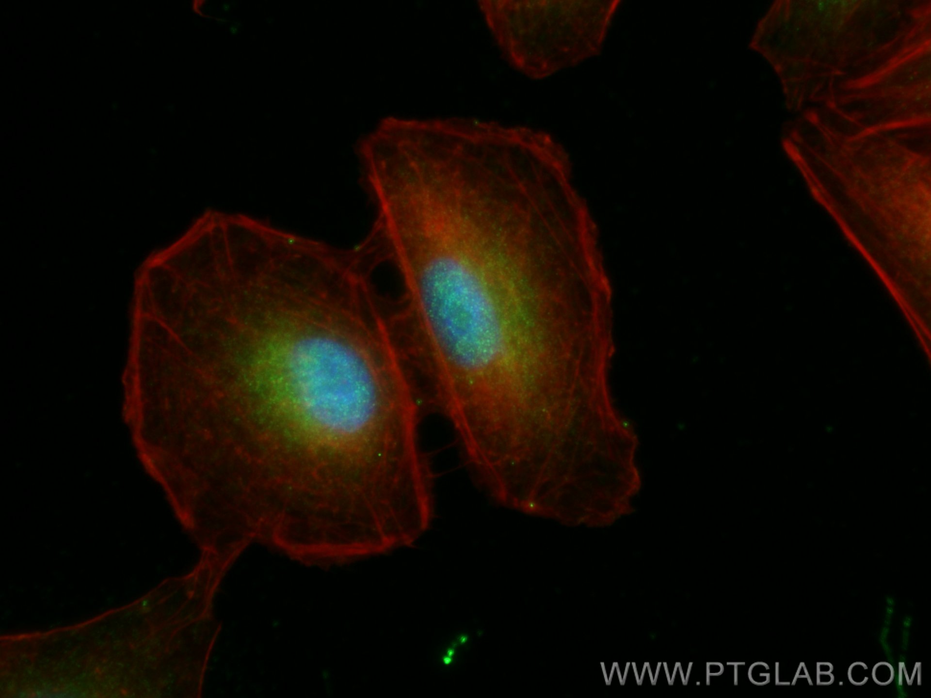 Immunofluorescence (IF) / fluorescent staining of A549 cells using ATAT1 Polyclonal antibody (28828-1-AP)