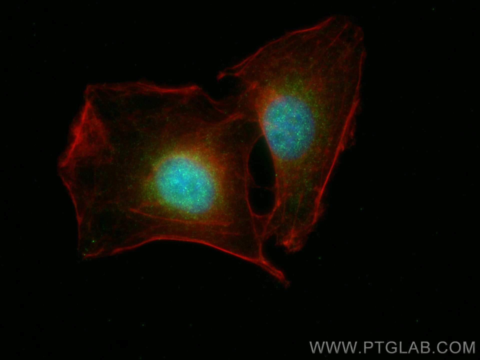 IF Staining of A549 using 28828-1-AP