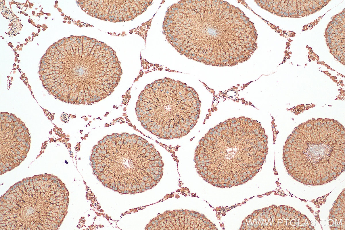 Immunohistochemistry (IHC) staining of rat testis tissue using ATAT1 Polyclonal antibody (28828-1-AP)