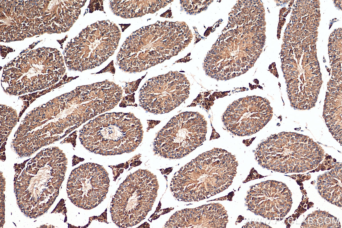Immunohistochemistry (IHC) staining of mouse testis tissue using ATAT1 Polyclonal antibody (28828-1-AP)