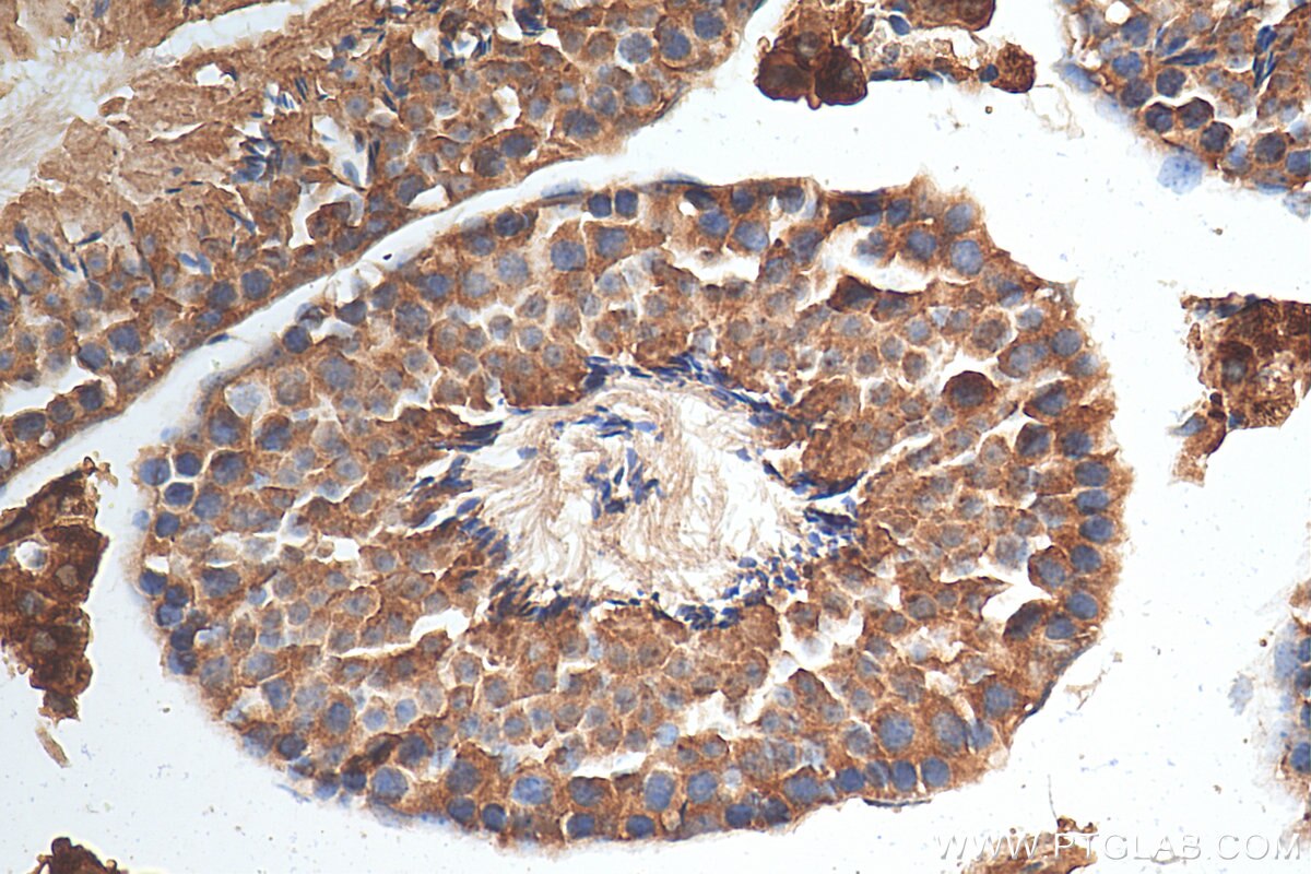 Immunohistochemistry (IHC) staining of mouse testis tissue using C6orf134 Polyclonal antibody (28828-1-AP)