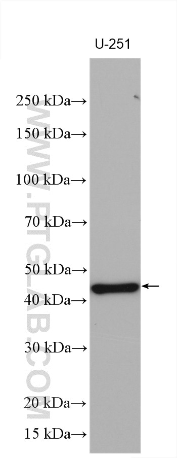 Western Blot (WB) analysis of various lysates using ATAT1 Polyclonal antibody (28828-1-AP)