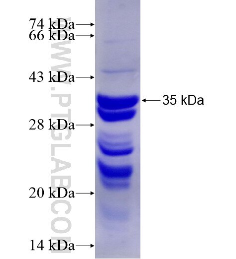 C6orf134 fusion protein Ag28757 SDS-PAGE