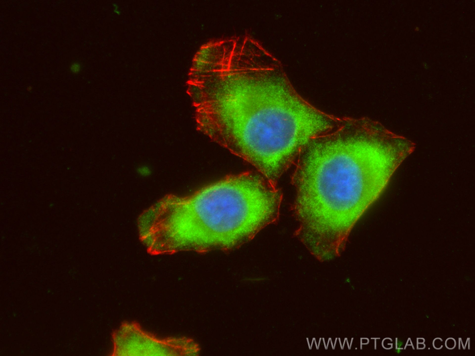 IF Staining of A375 using 24953-1-AP