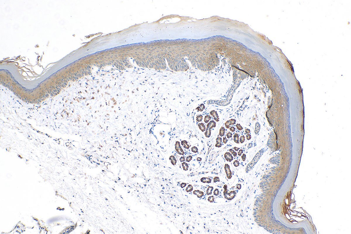 Immunohistochemistry (IHC) staining of mouse skin tissue using C6orf15 Polyclonal antibody (24953-1-AP)