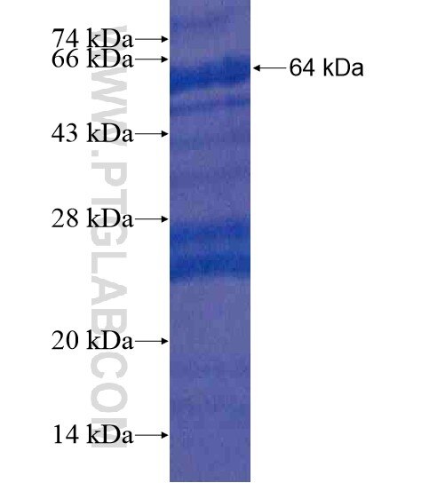 C6orf15 fusion protein Ag20276 SDS-PAGE