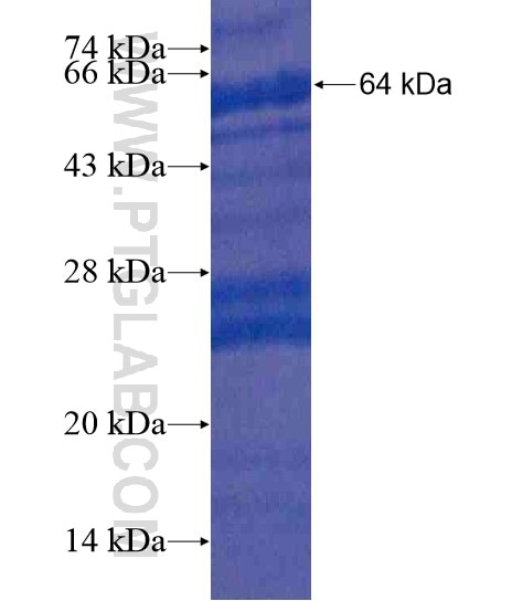 C6orf15 fusion protein Ag20276 SDS-PAGE