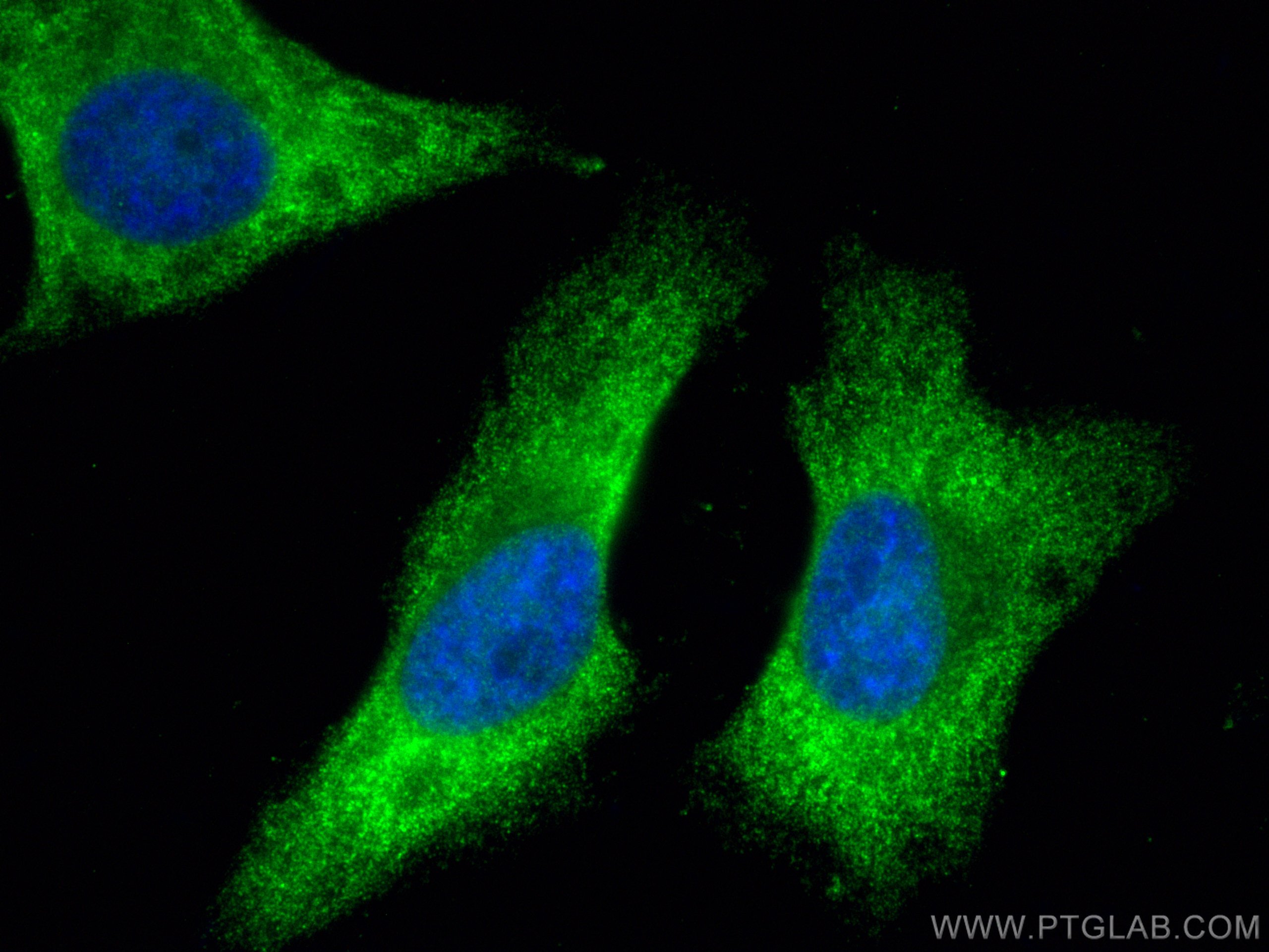 Immunofluorescence (IF) / fluorescent staining of HeLa cells using cGAS Polyclonal antibody (26416-1-AP)