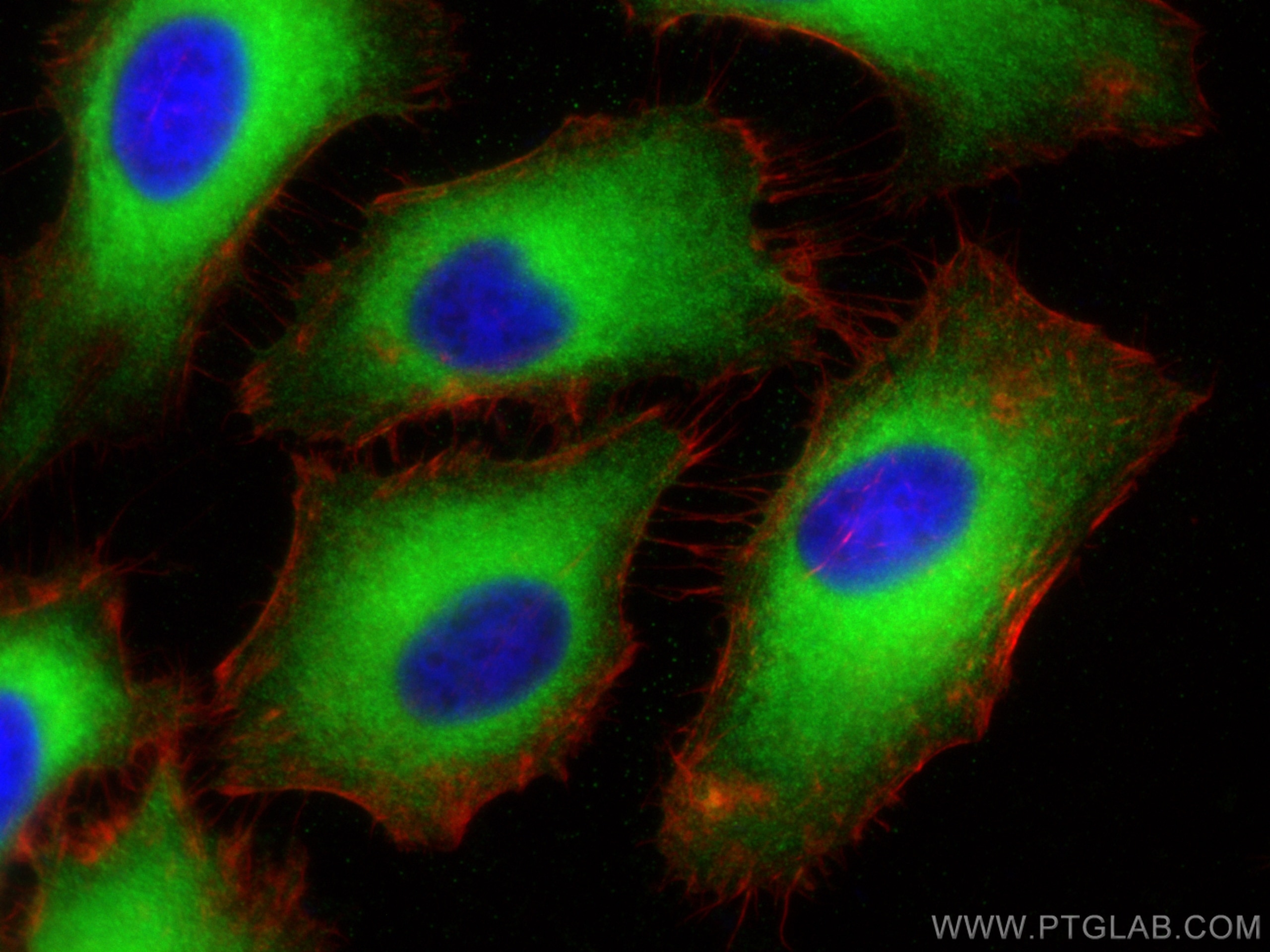 Immunofluorescence (IF) / fluorescent staining of HeLa cells using cGAS Polyclonal antibody (26416-1-AP)