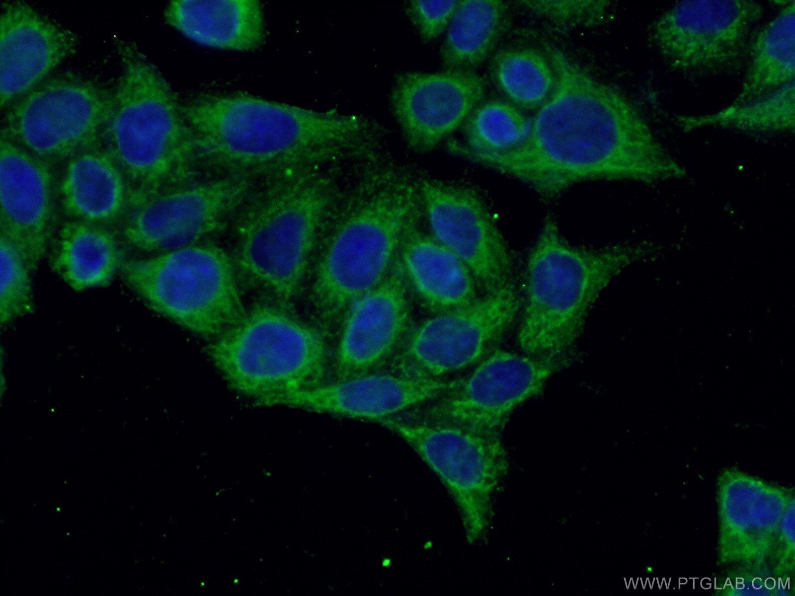 IF Staining of HeLa using 26416-1-AP