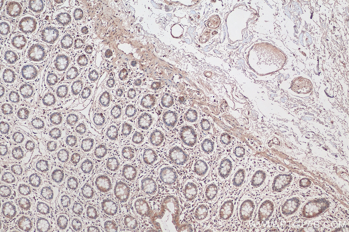 IHC staining of human colon using 26416-1-AP