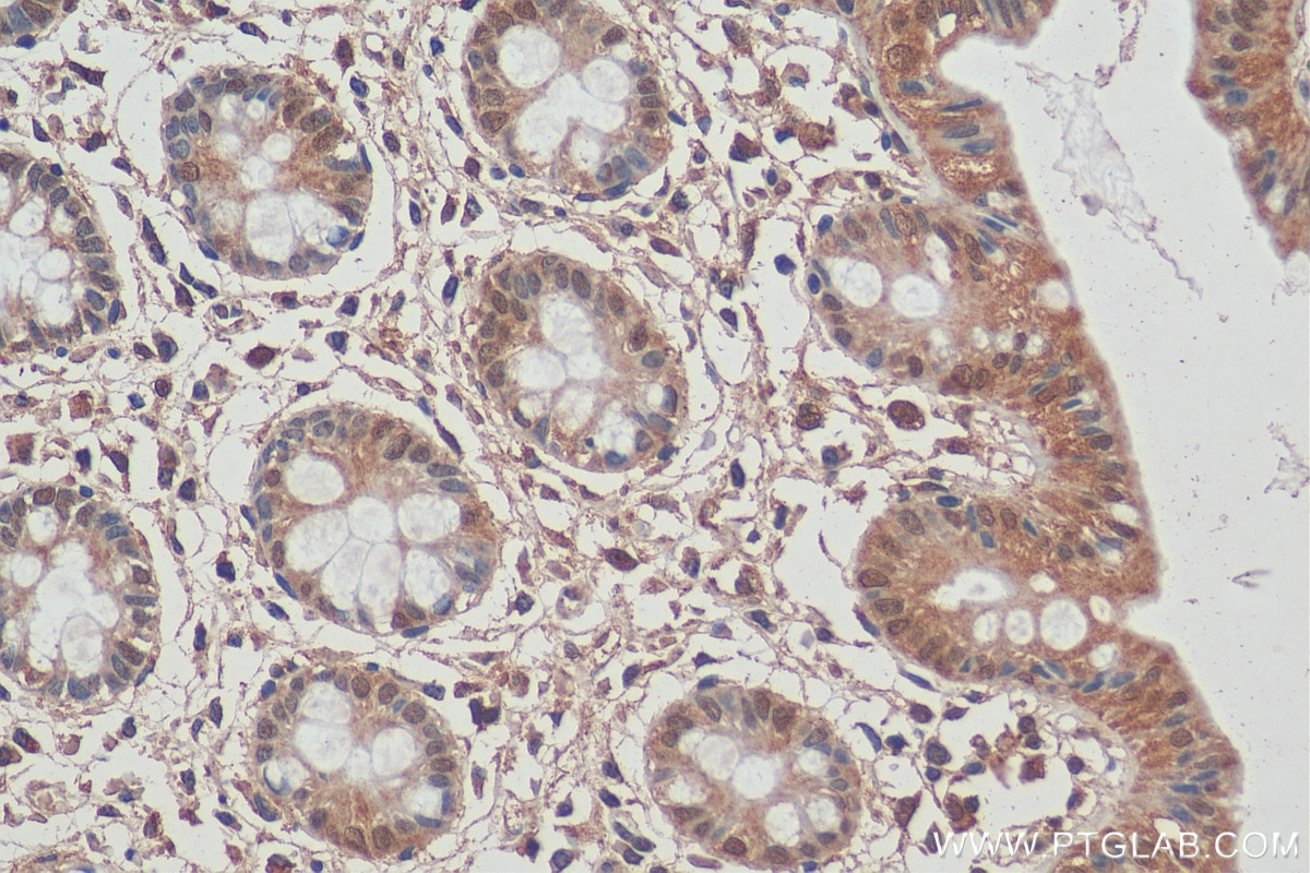 IHC staining of human colon using 26416-1-AP