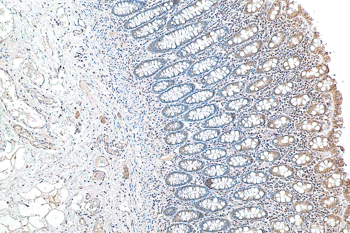 Immunohistochemistry (IHC) staining of human colon tissue using cGAS Polyclonal antibody (26416-1-AP)