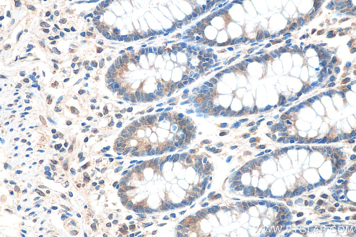 Immunohistochemistry (IHC) staining of human colon tissue using cGAS Polyclonal antibody (26416-1-AP)