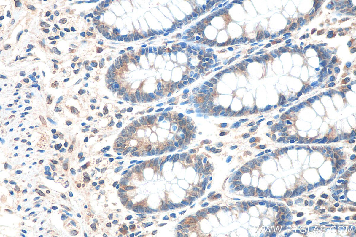 IHC staining of human colon using 26416-1-AP