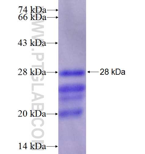 C6orf150 fusion protein Ag23455 SDS-PAGE