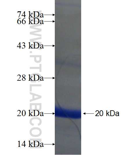 C6orf173 fusion protein Ag21580 SDS-PAGE
