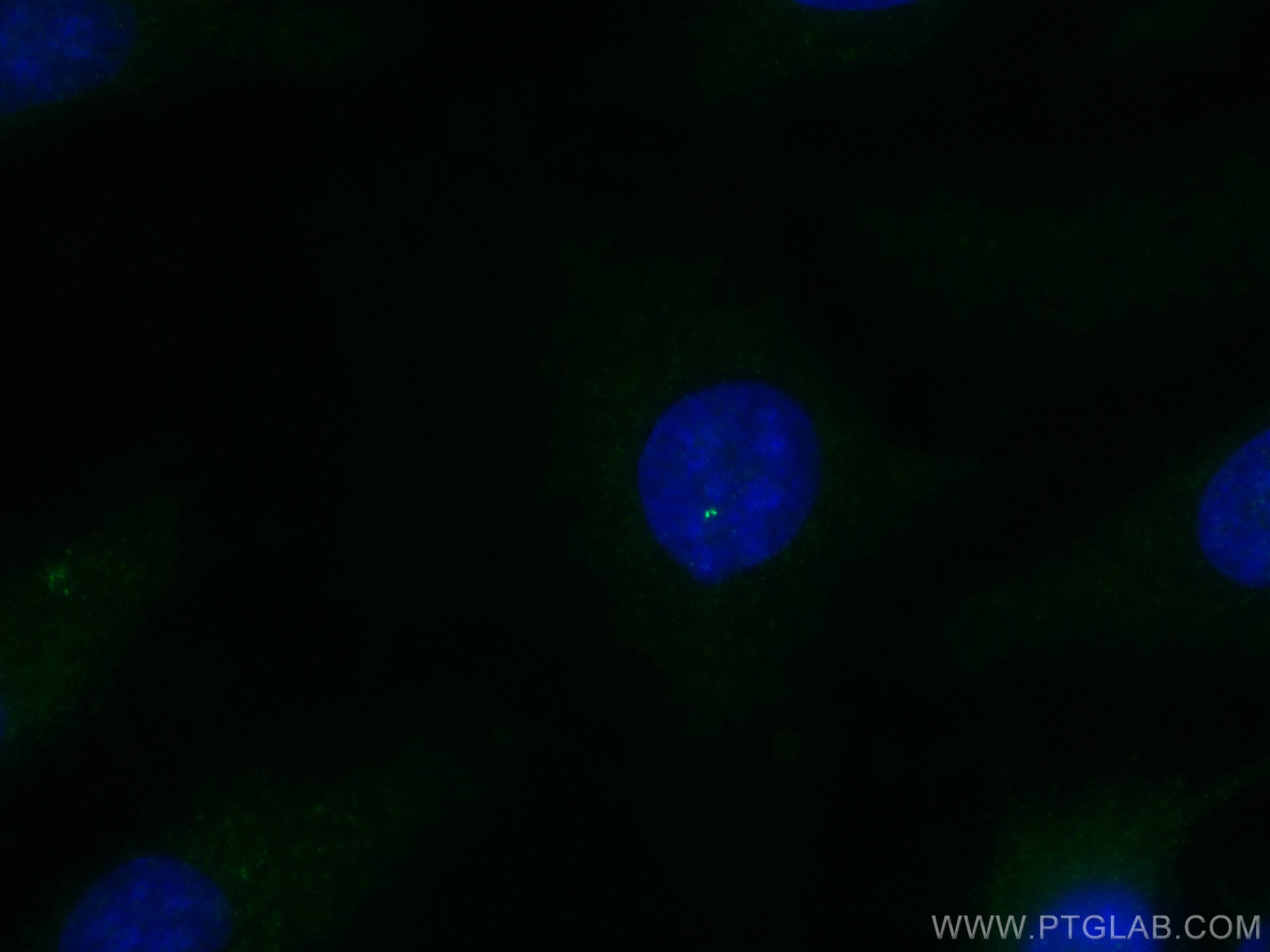 Immunofluorescence (IF) / fluorescent staining of HeLa cells using C6orf182 Polyclonal antibody (24957-1-AP)