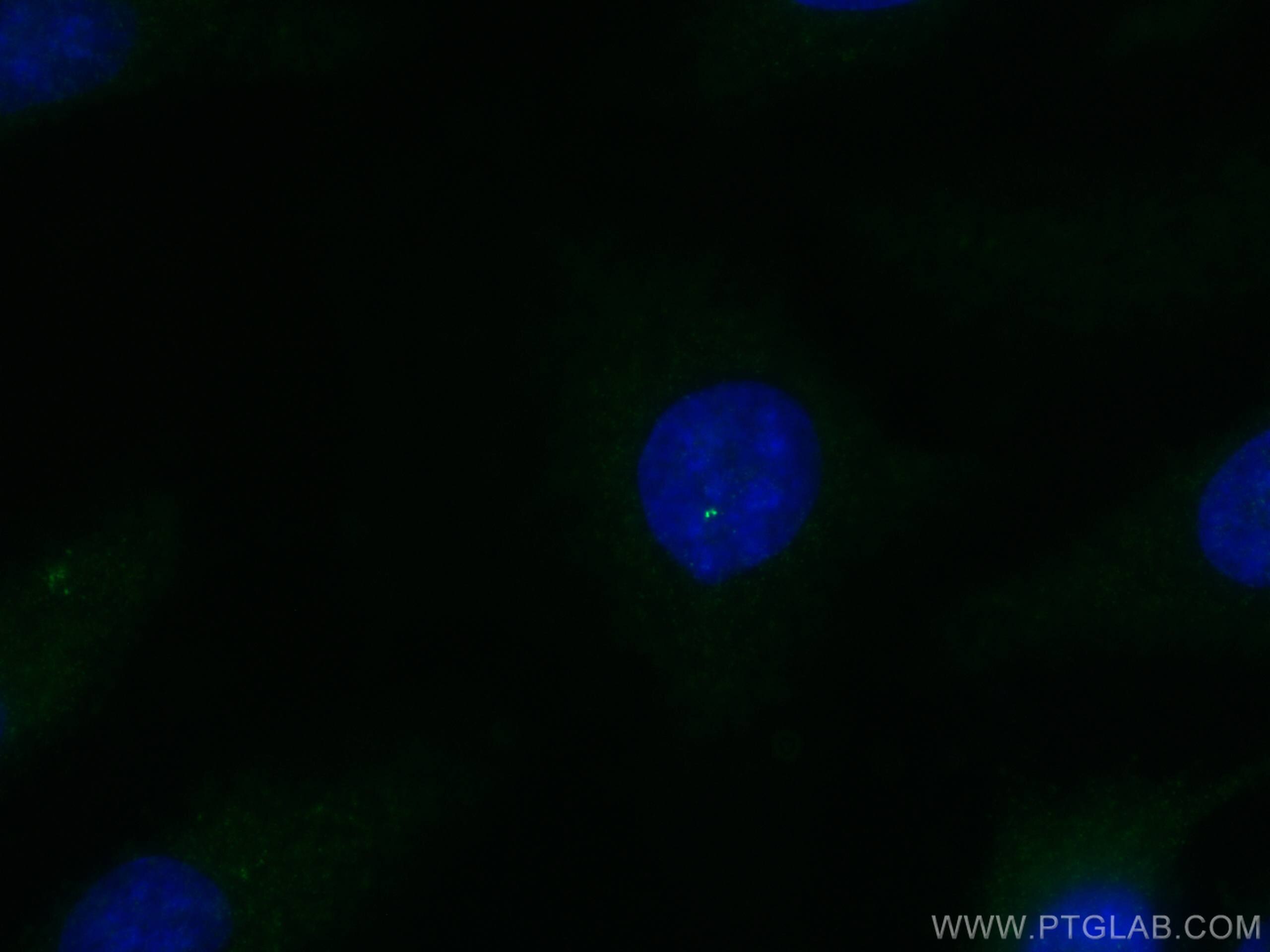 IF Staining of HeLa using 24957-1-AP