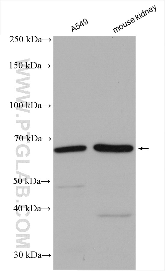 Western Blot (WB) analysis of various lysates using C6orf182 Polyclonal antibody (24957-1-AP)