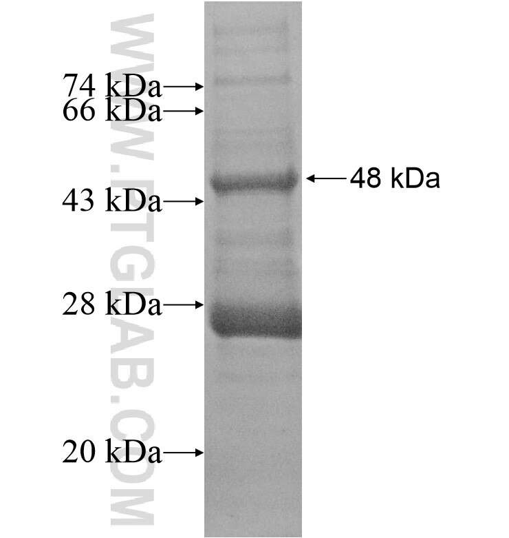 C6orf184 fusion protein Ag16611 SDS-PAGE C6orf184 fusion protein Ag16611 SDS-PAGE