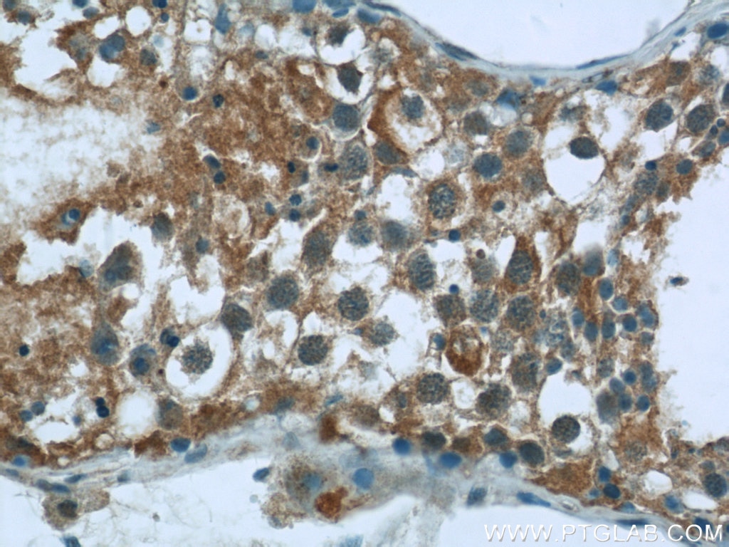 Immunohistochemistry (IHC) staining of human testis tissue using CEP85L Polyclonal antibody (24588-1-AP)