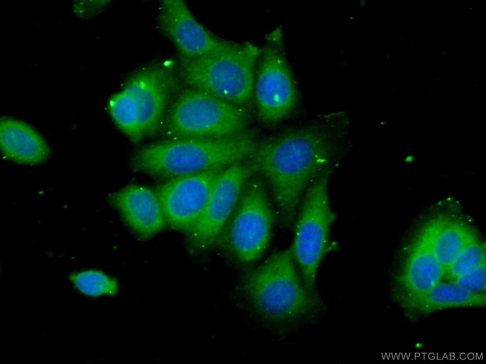 Immunofluorescence (IF) / fluorescent staining of MCF-7 cells using C6orf211/ARMT1 Polyclonal antibody (25124-1-AP)
