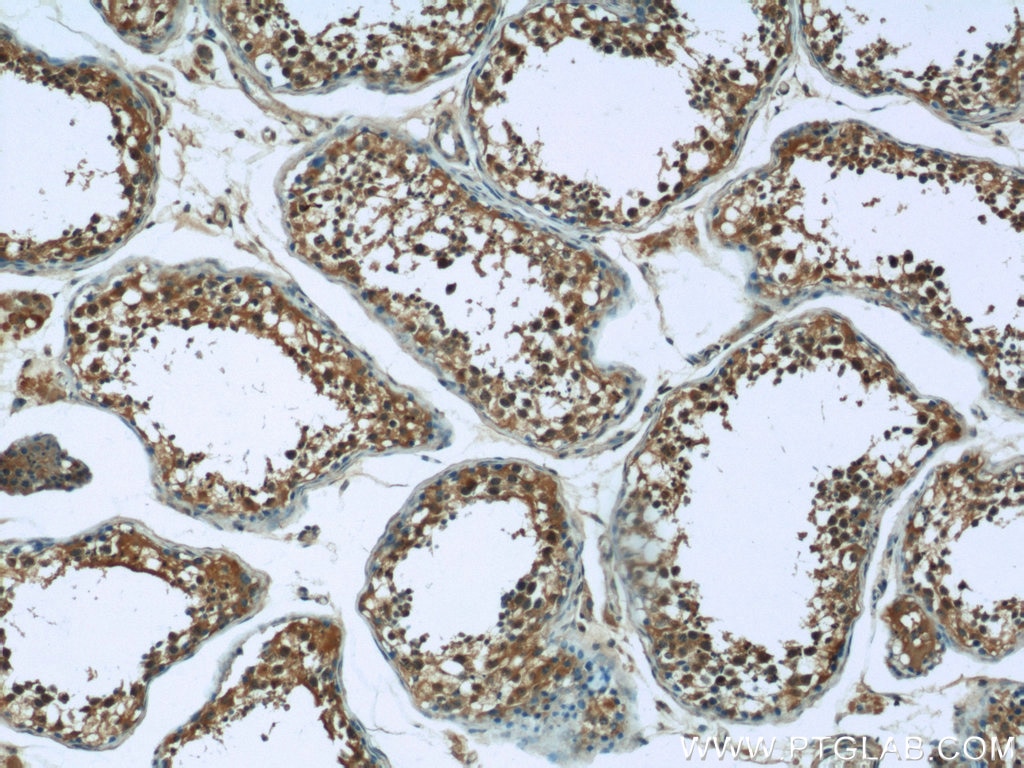 IHC staining of human testis using 25124-1-AP