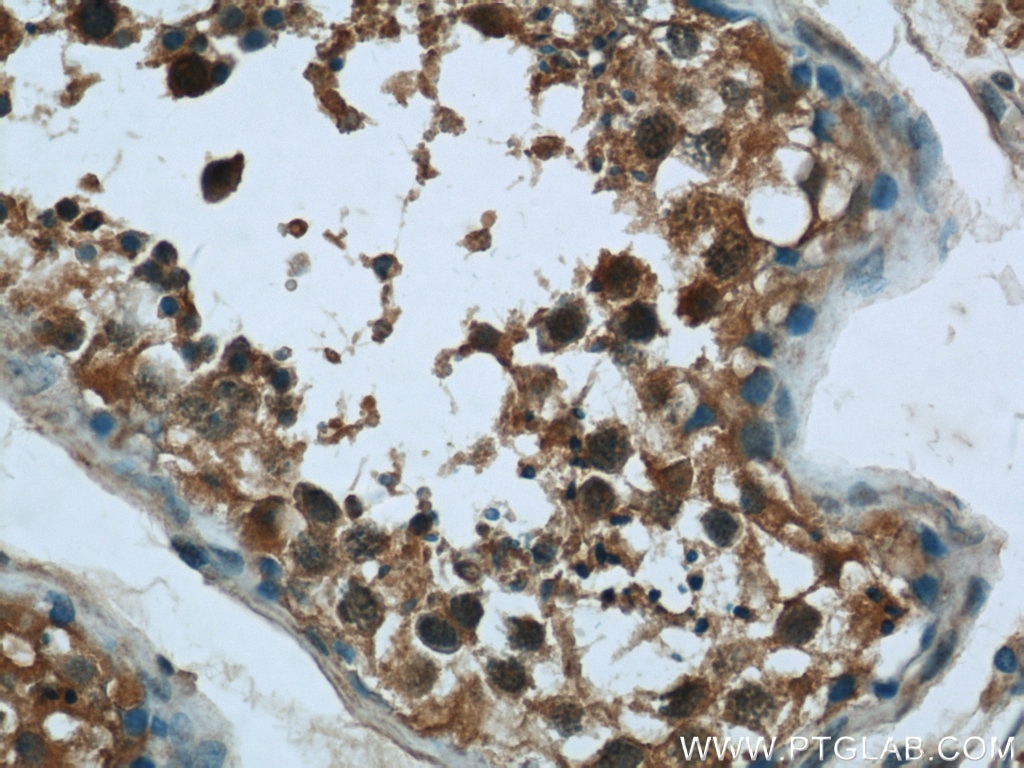 Immunohistochemistry (IHC) staining of human testis tissue using C6orf211/ARMT1 Polyclonal antibody (25124-1-AP)