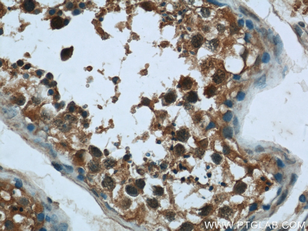 IHC staining of human testis using 25124-1-AP