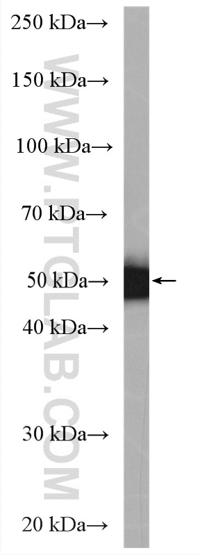 Western Blot (WB) analysis of T-47D cells using C6orf211/ARMT1 Polyclonal antibody (25124-1-AP)