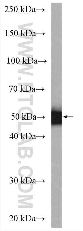 WB analysis of T-47D using 25124-1-AP