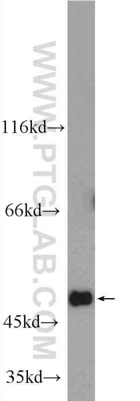 Western Blot (WB) analysis of HEK-293 cells using C6orf211/ARMT1 Polyclonal antibody (25124-1-AP)