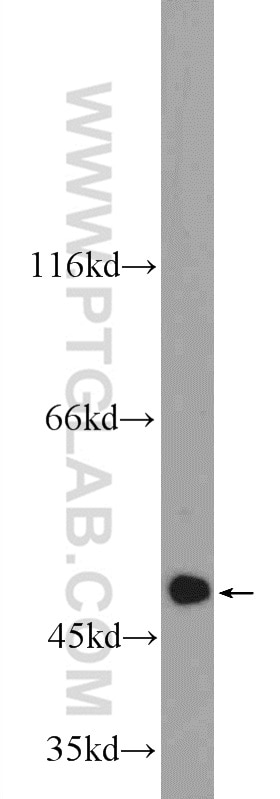 WB analysis of MCF-7 using 25124-1-AP