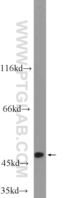 Western Blot (WB) analysis of A431 cells using C6orf211/ARMT1 Polyclonal antibody (25124-1-AP)