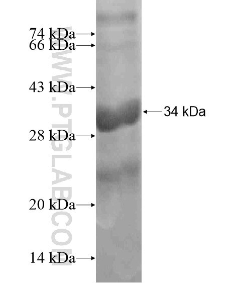 C6orf218 fusion protein Ag19529 SDS-PAGE