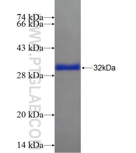 C6orf221 fusion protein Ag21790 SDS-PAGE