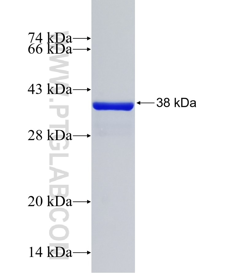 C6orf57 fusion protein Ag33549 SDS-PAGE C6orf57 fusion protein Ag33549 SDS-PAGE