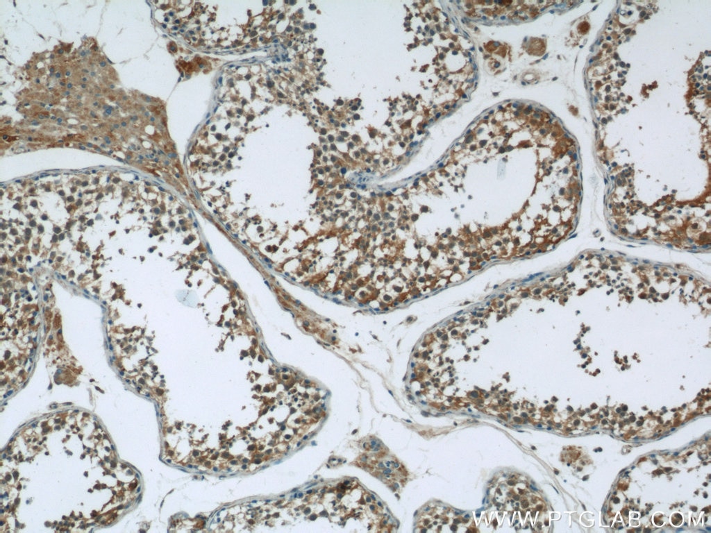 Immunohistochemistry (IHC) staining of human testis tissue using C6orf70 Polyclonal antibody (24690-1-AP)