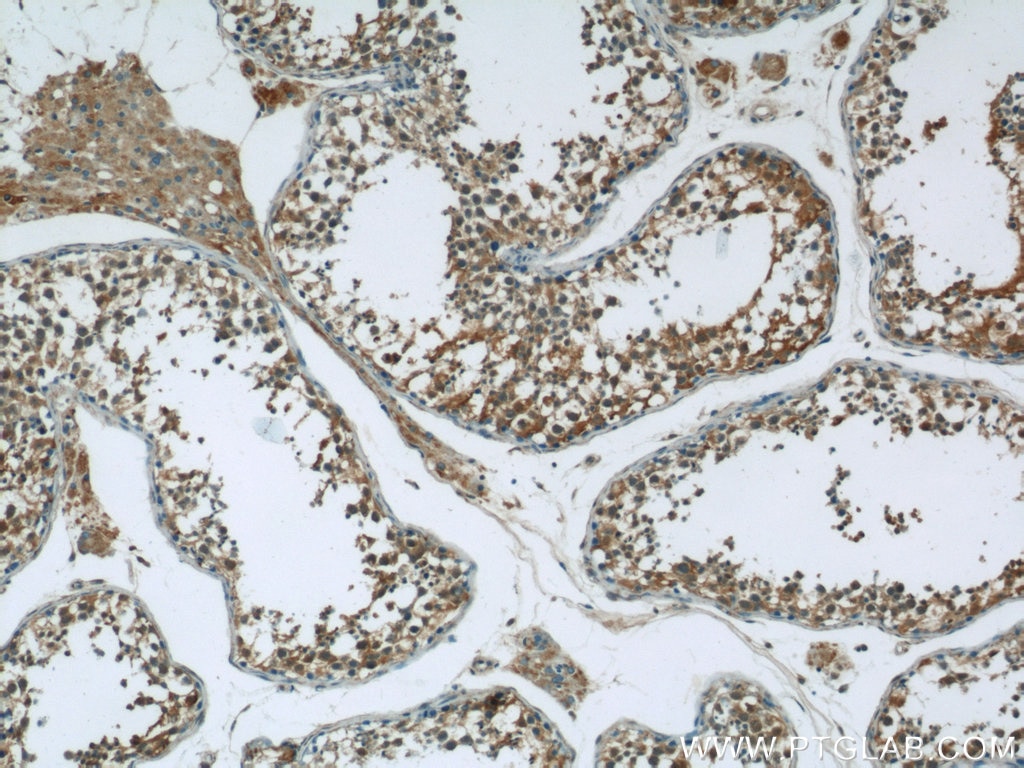 IHC staining of human testis using 24690-1-AP