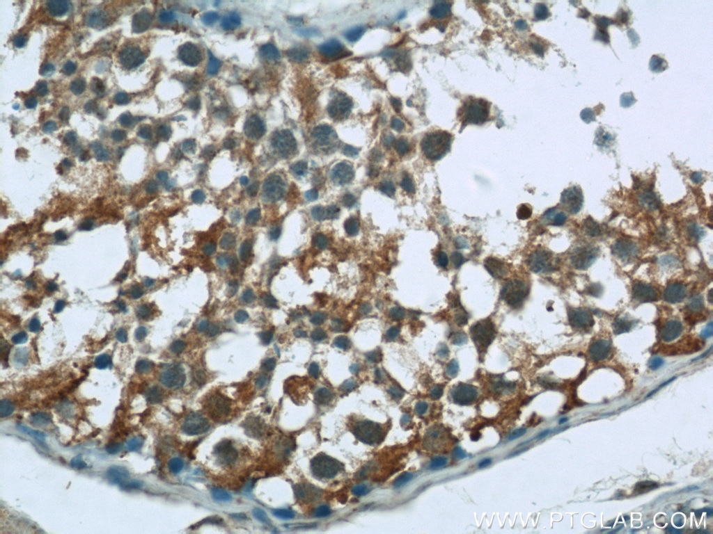 IHC staining of human testis using 24690-1-AP