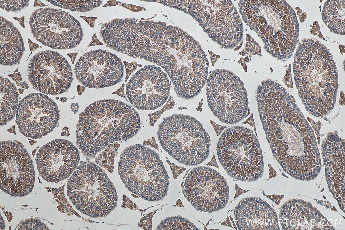 Immunohistochemistry (IHC) staining of mouse testis tissue using C6orf70 Polyclonal antibody (24690-1-AP)