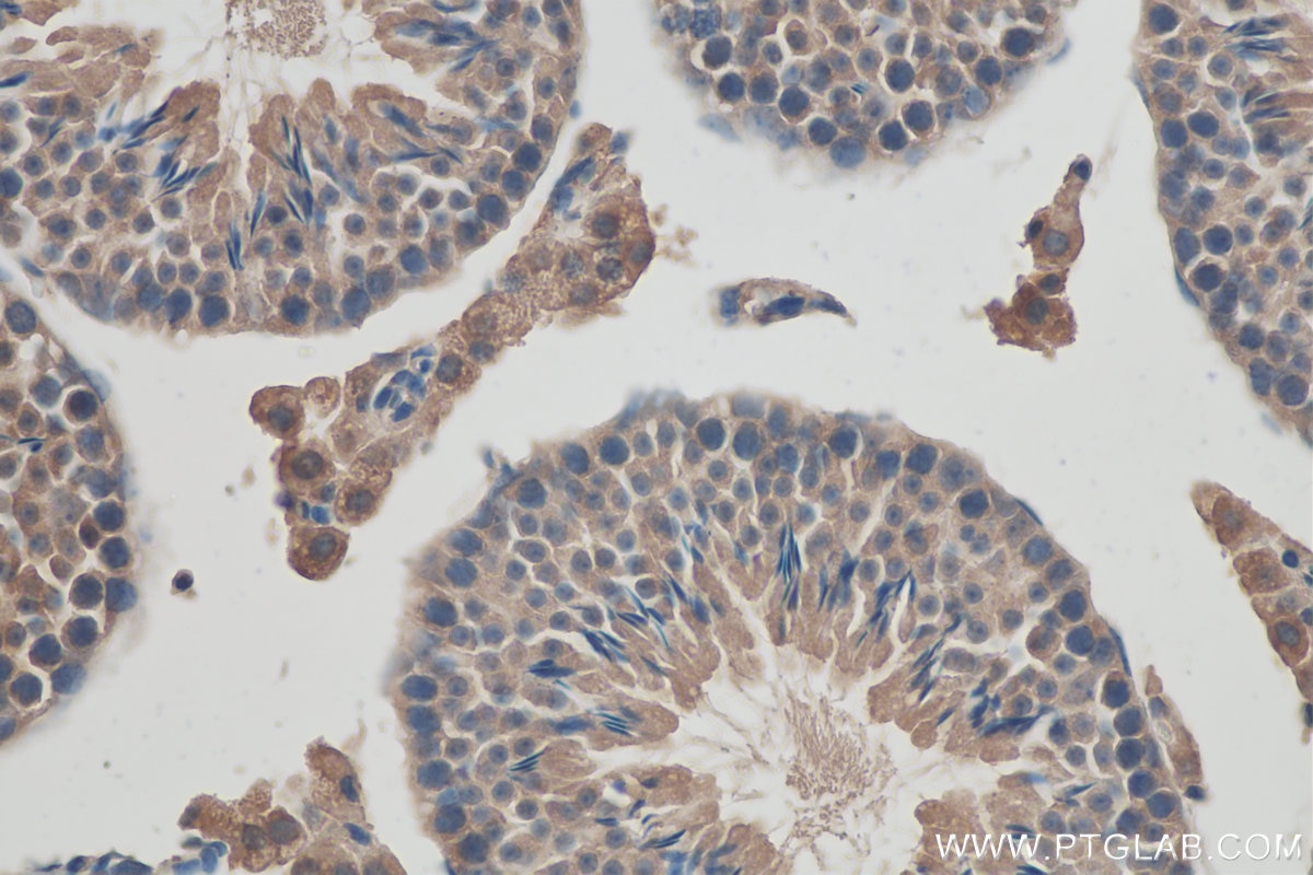 Immunohistochemistry (IHC) staining of mouse testis tissue using C6orf70 Polyclonal antibody (24690-1-AP)