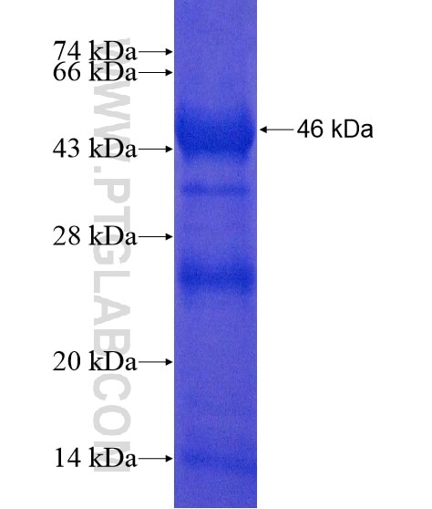 C6orf70 fusion protein Ag20413 SDS-PAGE